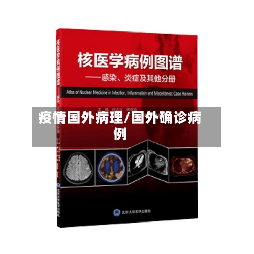 疫情国外病理/国外确诊病例